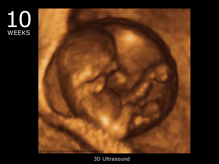 15 week fetus 3d ultrasound