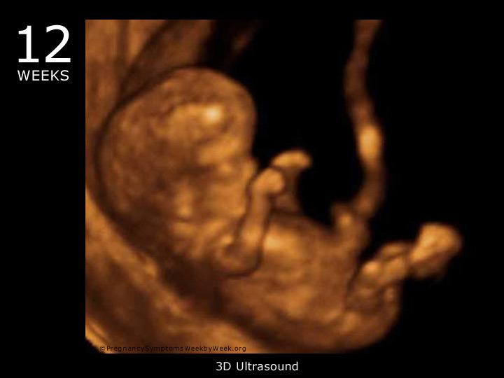 normal heartbeat for 12 week fetus