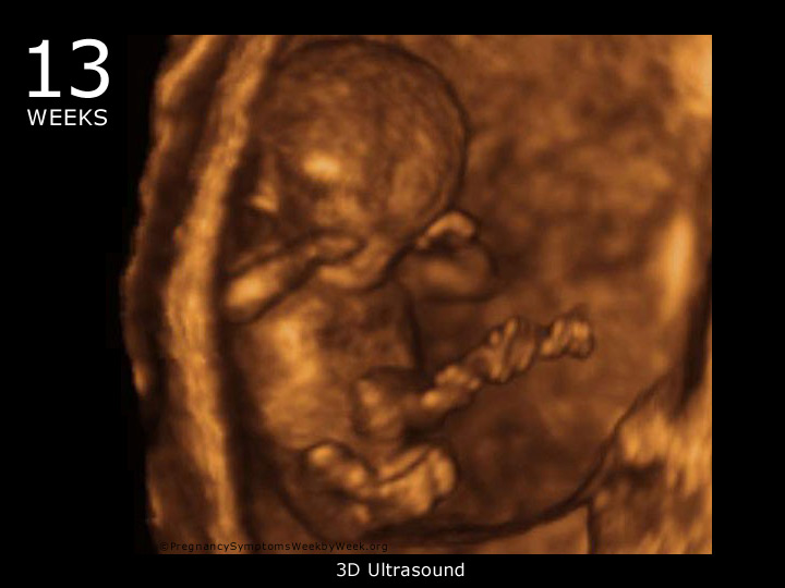 13-week-3d-ultrasound-baby-picture-pregnancy-symptoms-week-by-week