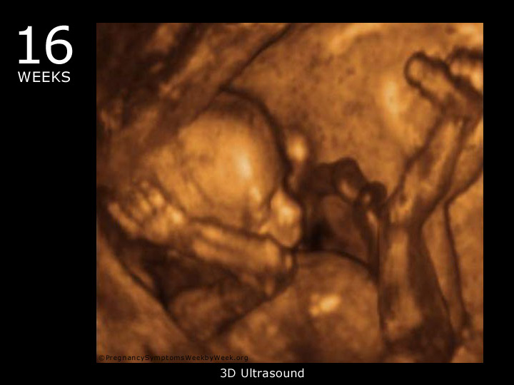 16 week ultrasound 3D