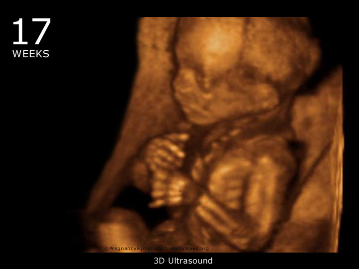 34 week 4d ultrasound pictures