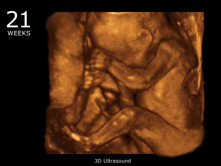 21 week ultrasound 3D