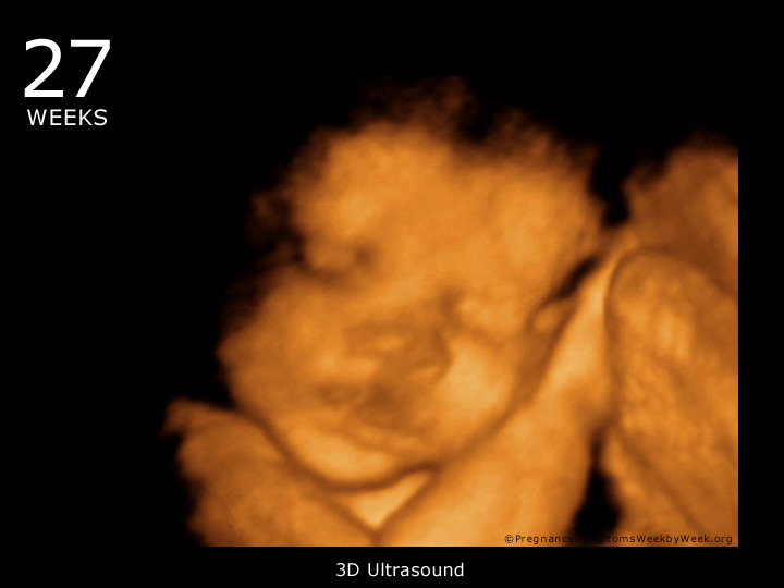 6 week 4d ultrasound pictures