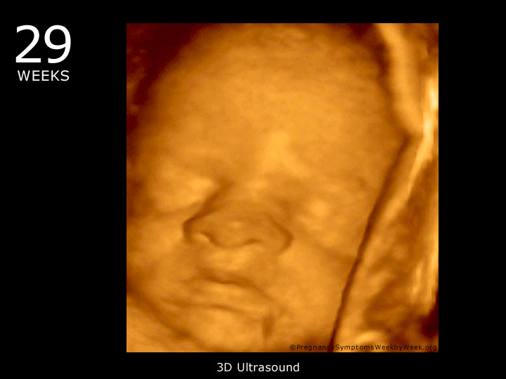 29 weeks fetus ultrasound