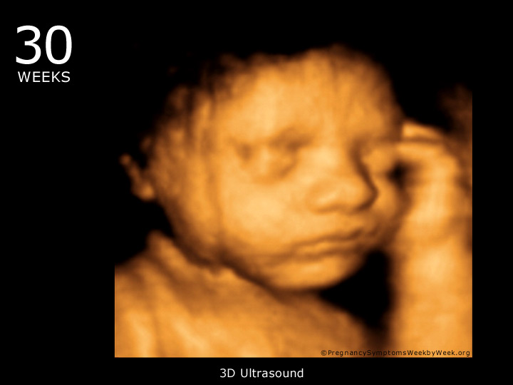 4d ultrasound pictures 30 weeks